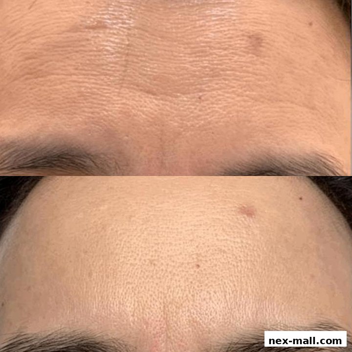 Before and after comparison of facial skin treatment, showing reduced wrinkles and pigmentation.
