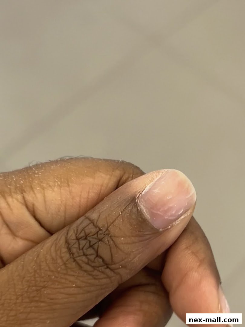 Close-up of a person's finger with a natural nail, showing skin texture.