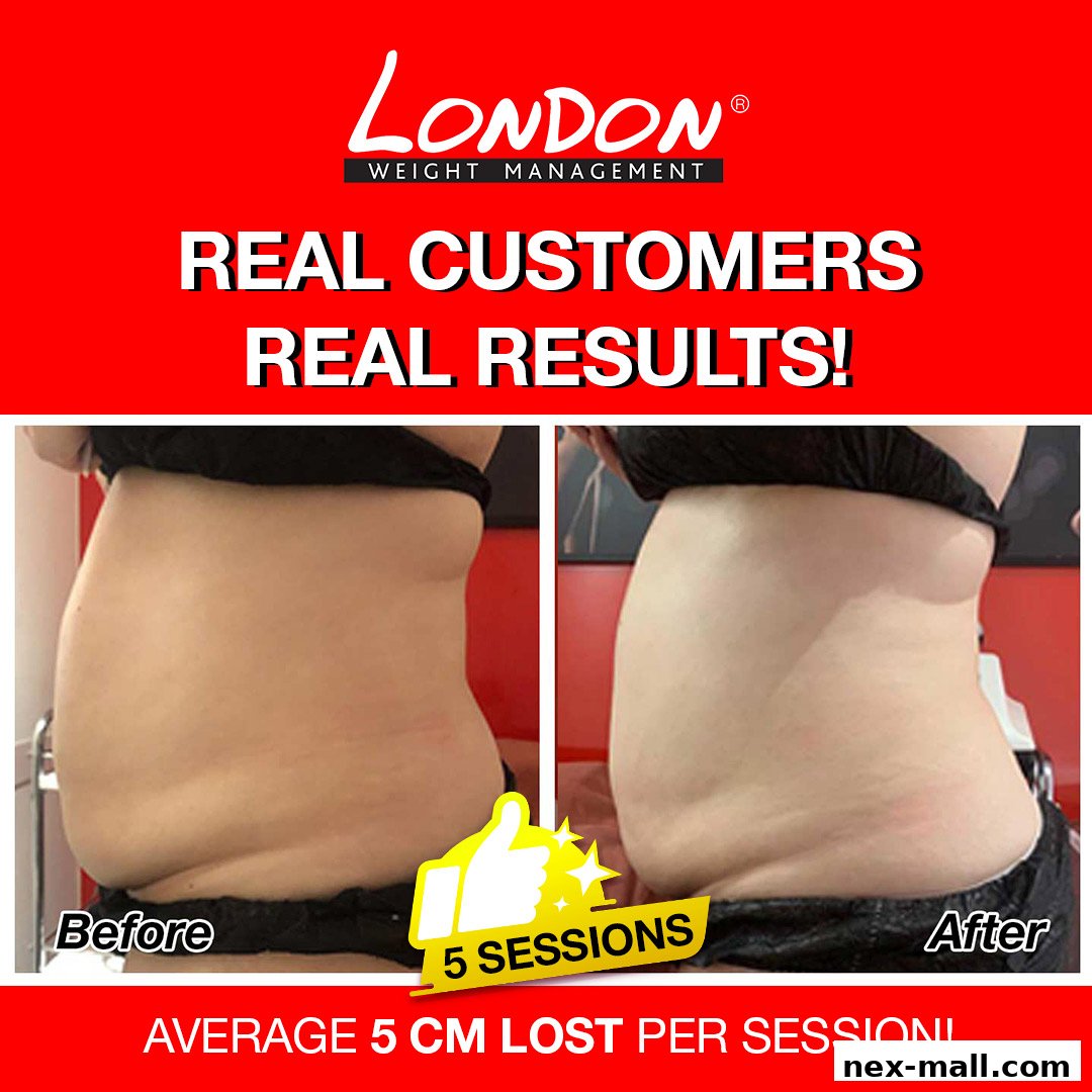 Before and after photos showcasing weight loss results from London Weight Management.