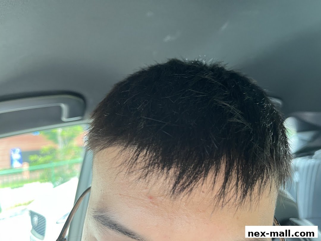 Close-up of a person's forehead and dark hair, with a blurred background.