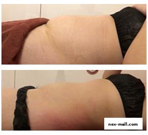 Before and after comparison of a person's midsection showing weight loss results.