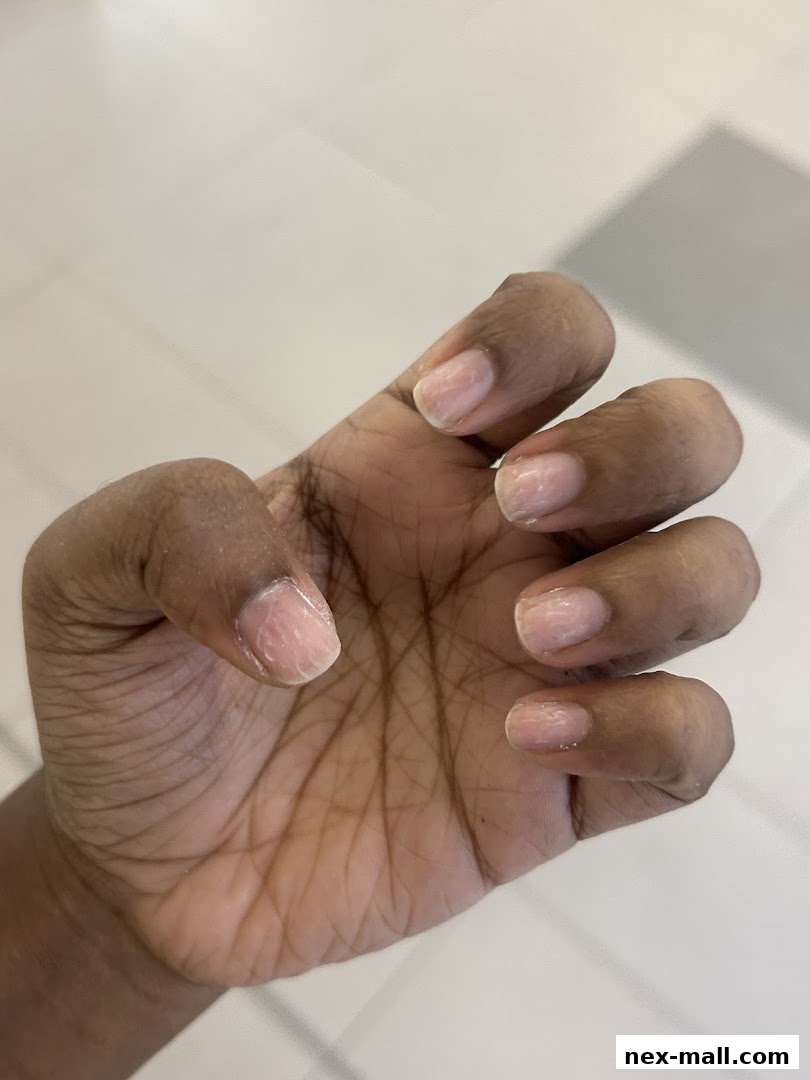 A close-up shot of a person's hand with unpolished nails.