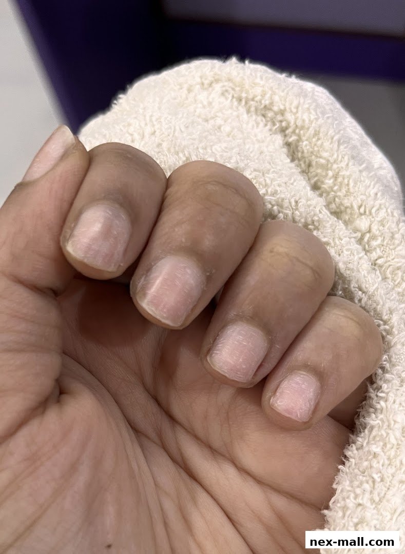 A close-up shot of a hand with unpolished fingernails, partially covered by a soft towel.