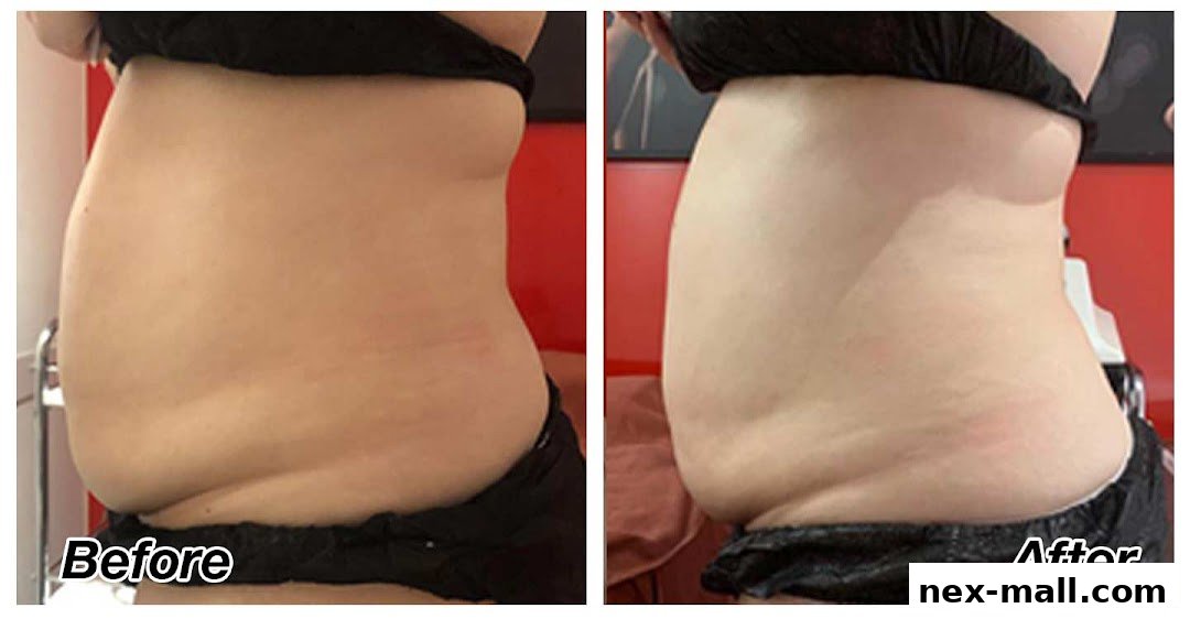 Before and after images showcasing a person's midsection after a weight loss treatment.