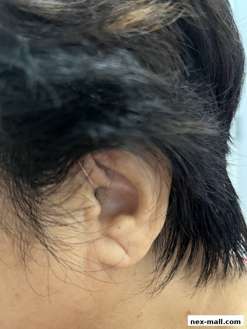 Close-up of a person's ear with dark hair, suggesting a hearing-related service.
