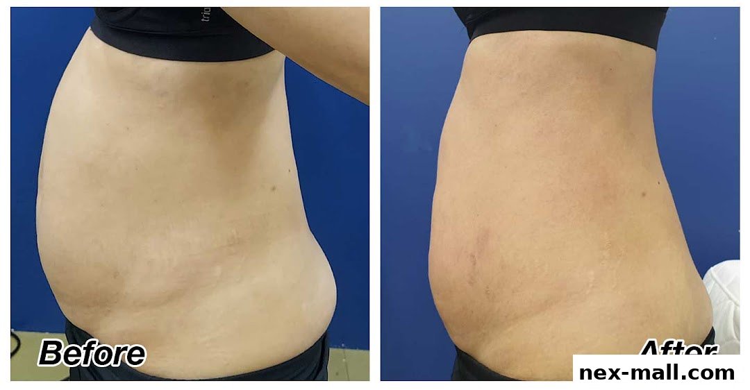 Before and after images showcasing a person's midsection transformation.