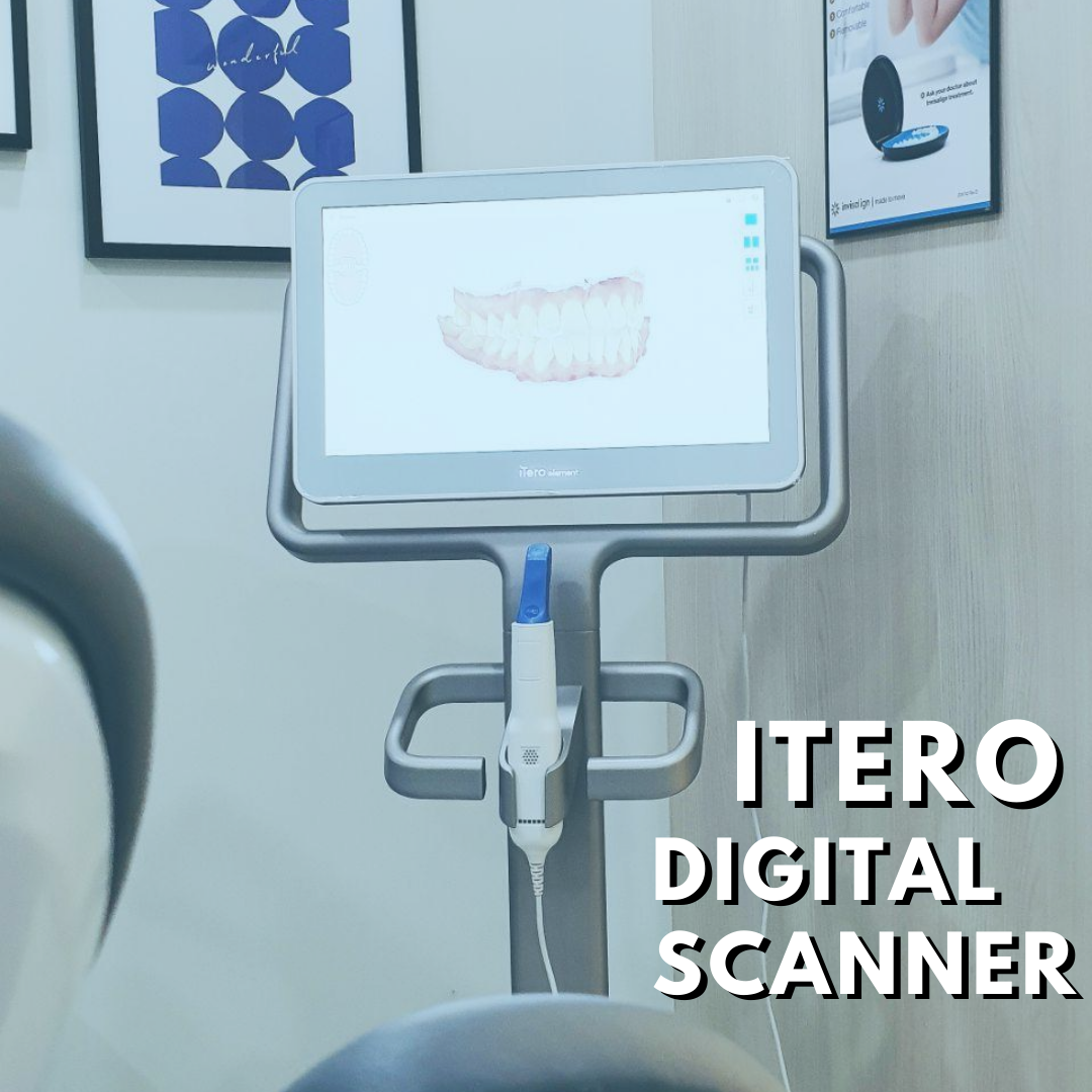 An iTero digital scanner displaying a 3D dental model, highlighting modern orthodontic technology.