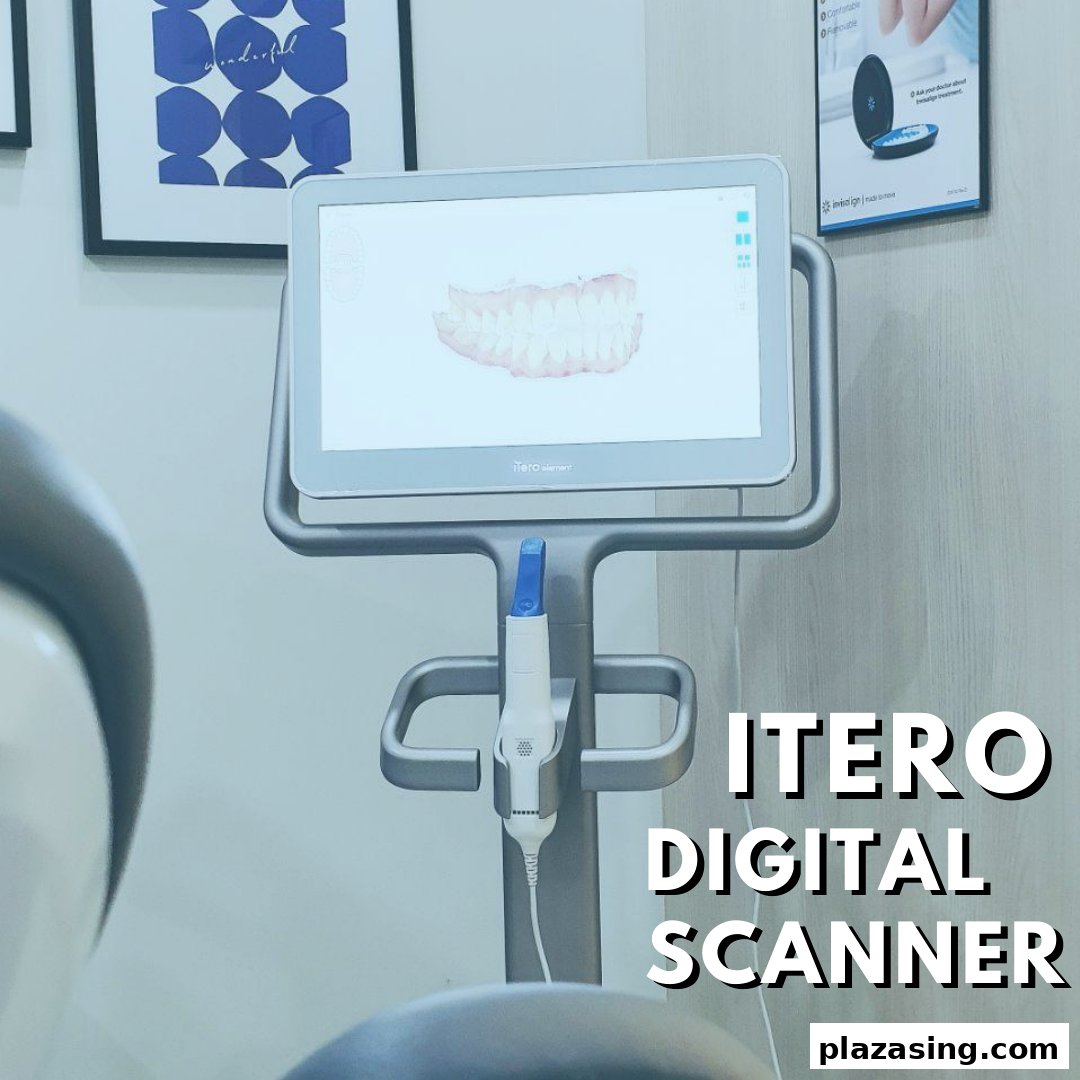 An iTero digital scanner displaying a 3D dental model, highlighting modern orthodontic technology.