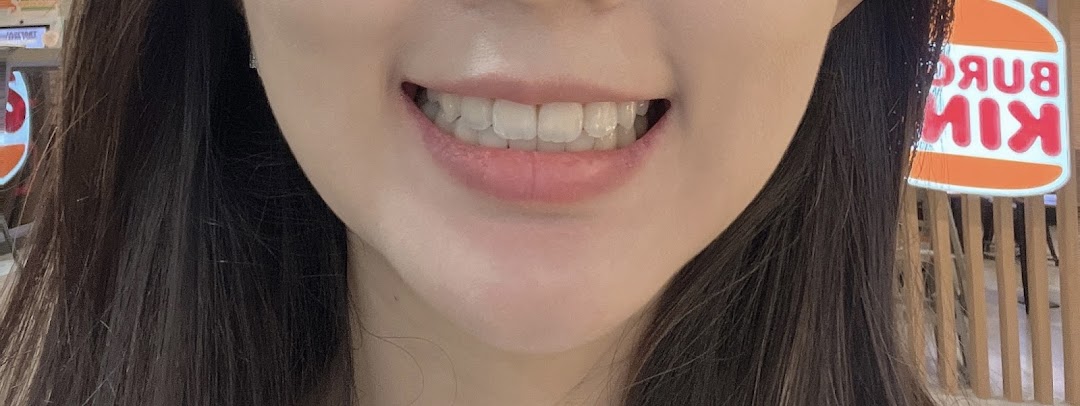 A close-up of a smiling person showcasing clear dental aligners on their teeth.