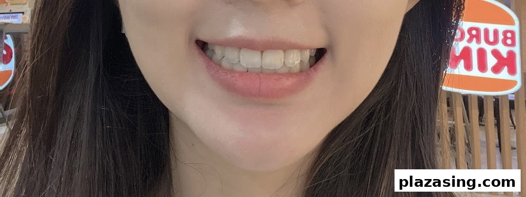 A close-up of a smiling person showcasing clear dental aligners on their teeth.