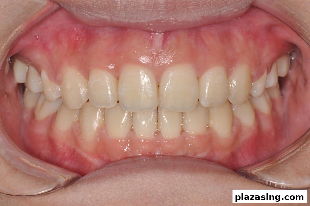 A close-up view of a patient's healthy teeth and gums, likely for dental assessment.