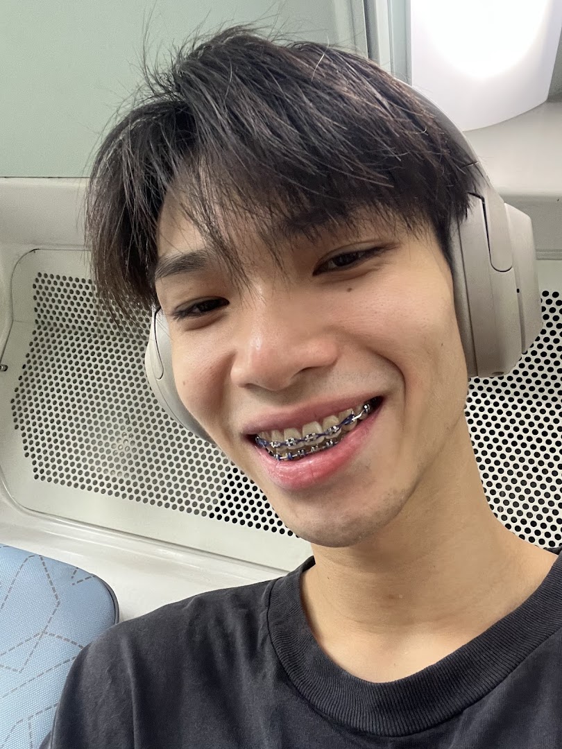 A young person with braces smiles, showcasing their orthodontic treatment results.