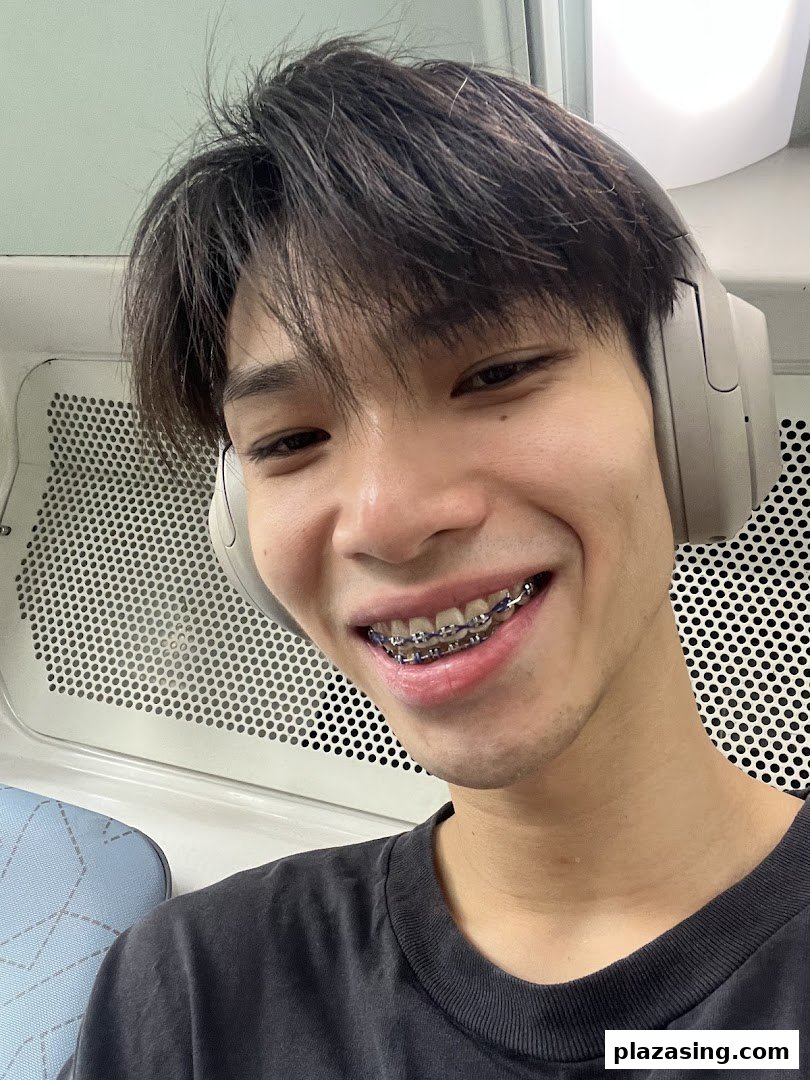 A young person with braces smiles, showcasing their orthodontic treatment results.