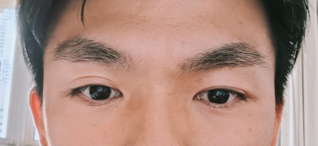 Close-up of a person's eyes and well-groomed eyebrows, highlighting brow treatment results.