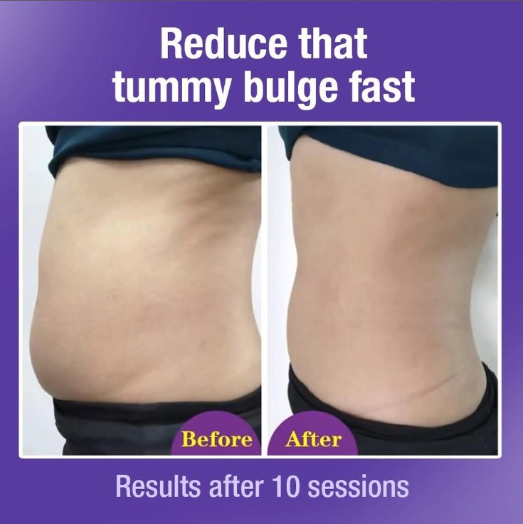 Dorra Slimming - Plaza Singapura  Lower Body Slimming Treatment Expert image 23