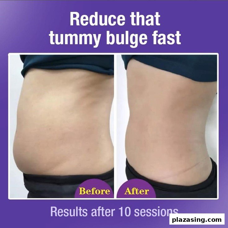 Dorra Slimming - Plaza Singapura  Lower Body Slimming Treatment Expert image 23