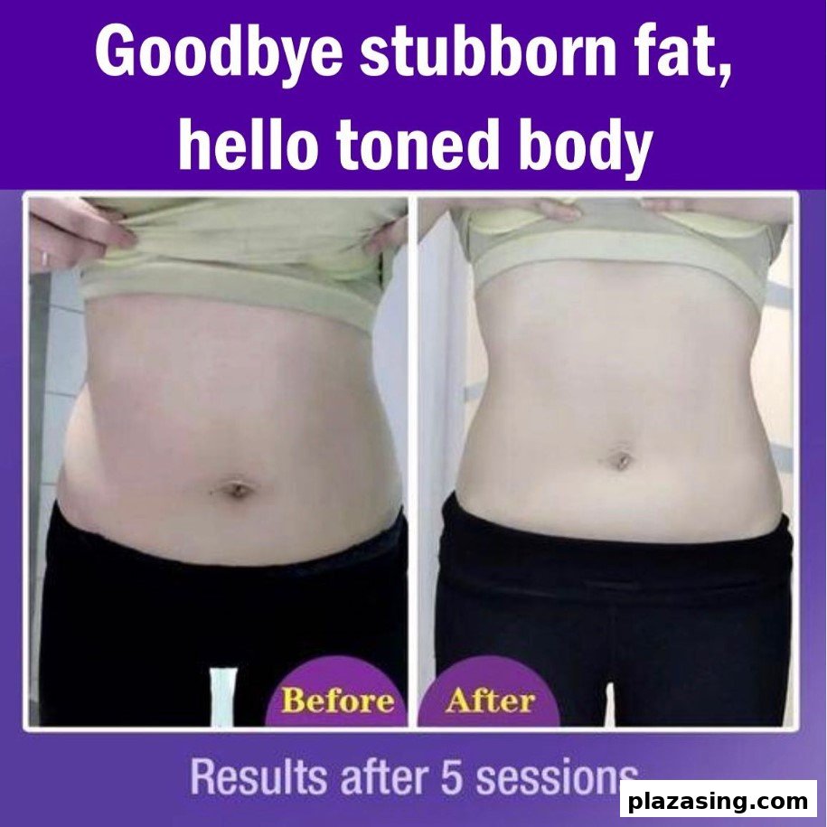 A before-and-after comparison showcasing slimming results on a person's midsection after 5 sessions.