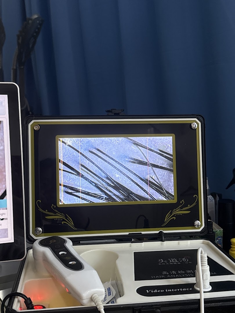 A hair analysis device displaying magnified hair follicles on its screen.