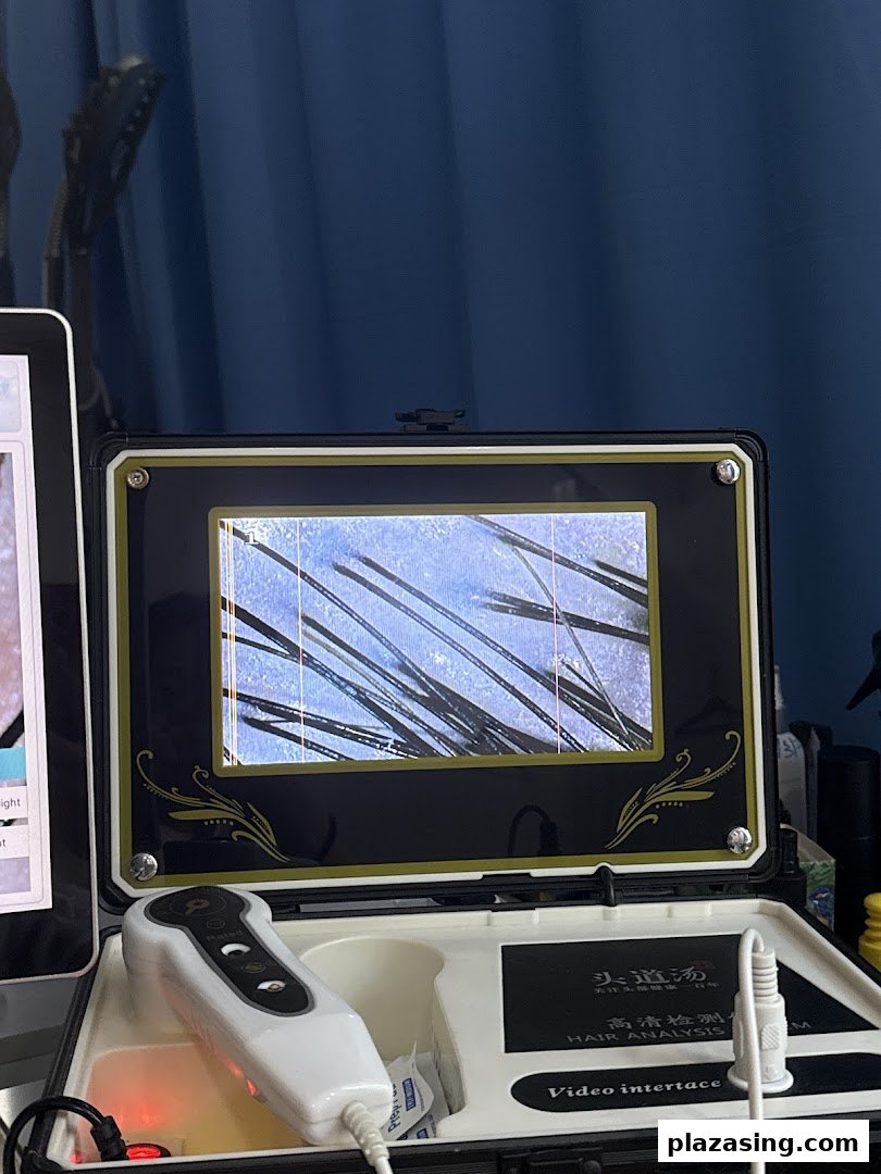 A hair analysis device displaying magnified hair follicles on its screen.