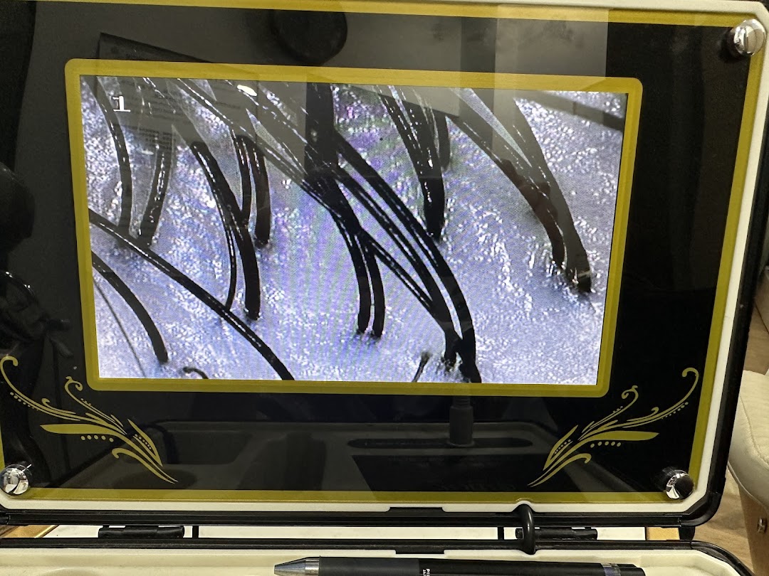 A magnified view of hair follicles and scalp displayed on a diagnostic screen.