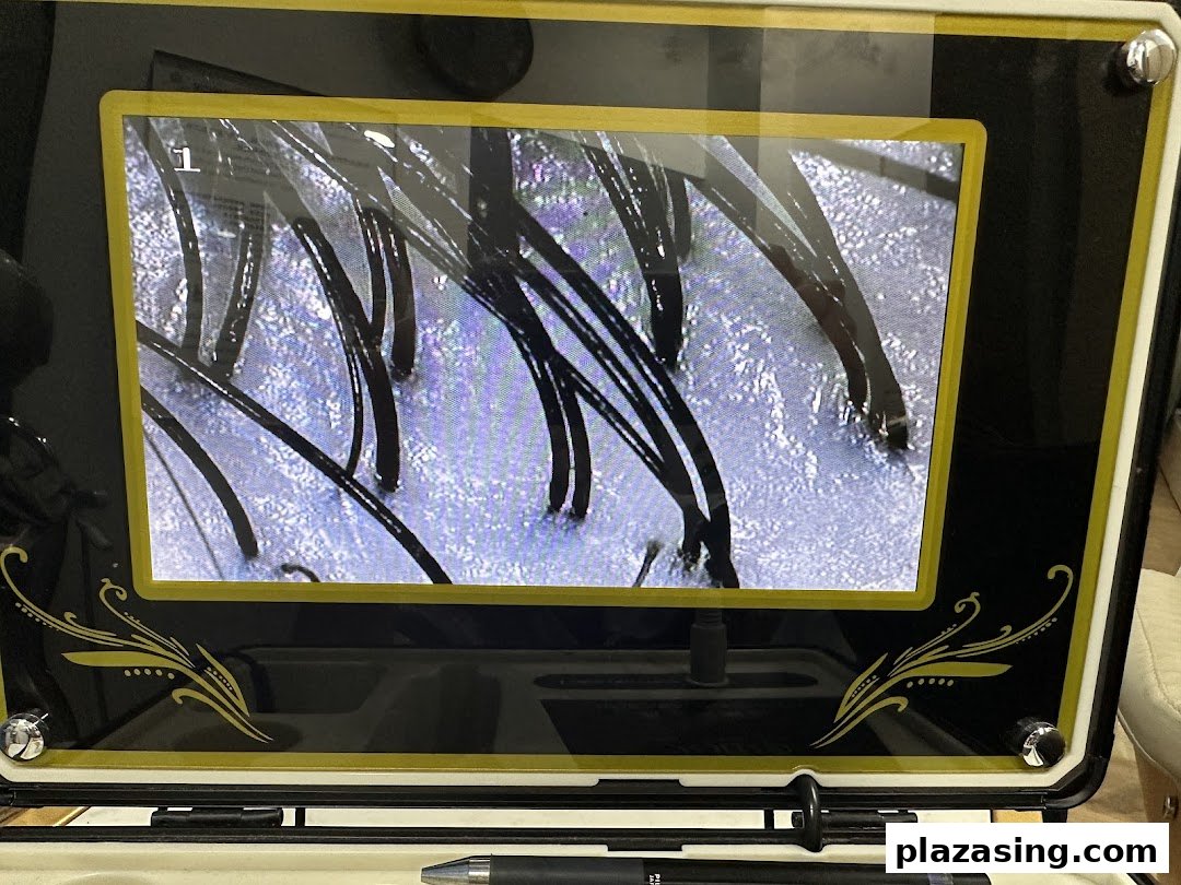 A magnified view of hair follicles and scalp displayed on a diagnostic screen.