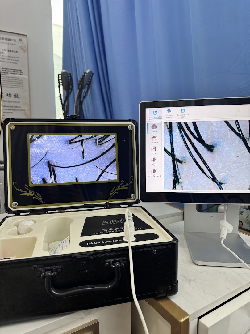 Close-up of advanced hair and scalp analysis equipment displaying magnified views on two screens.