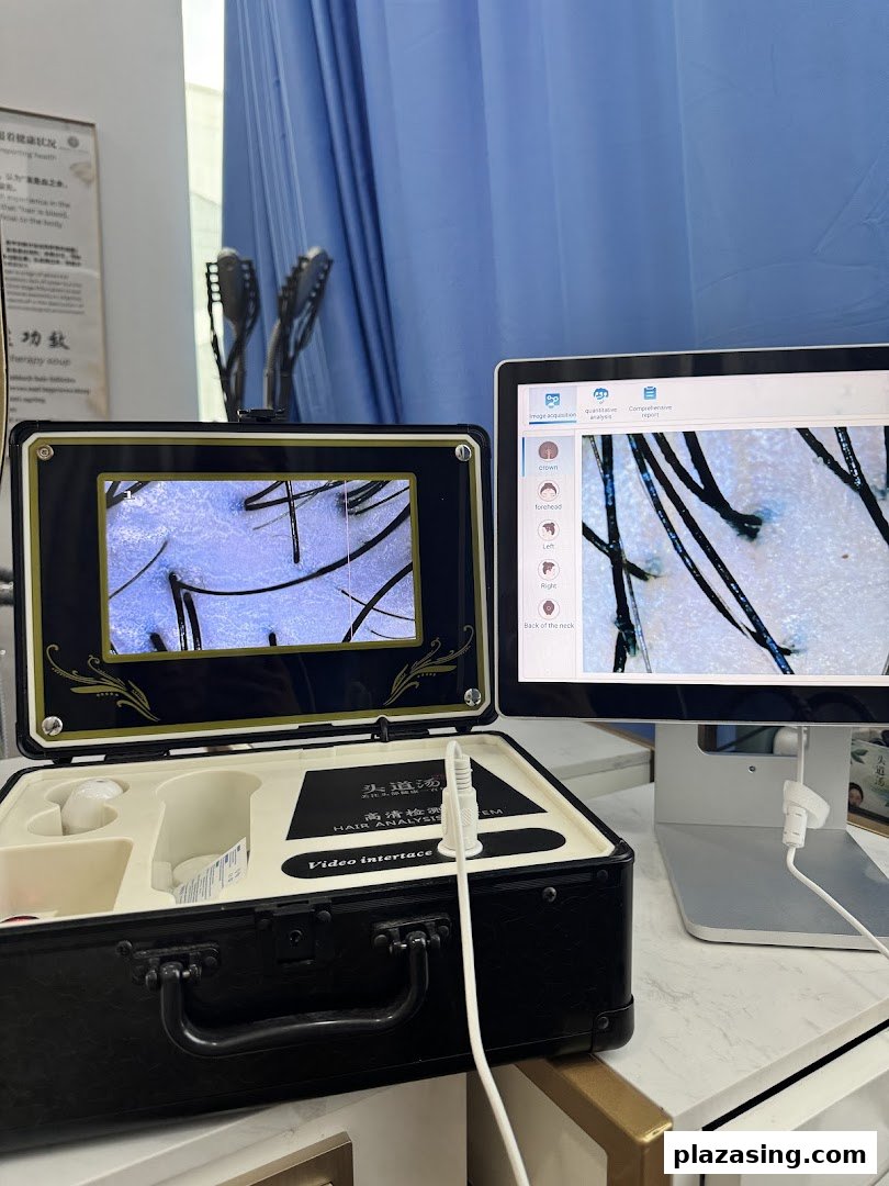 Close-up of advanced hair and scalp analysis equipment displaying magnified views on two screens.
