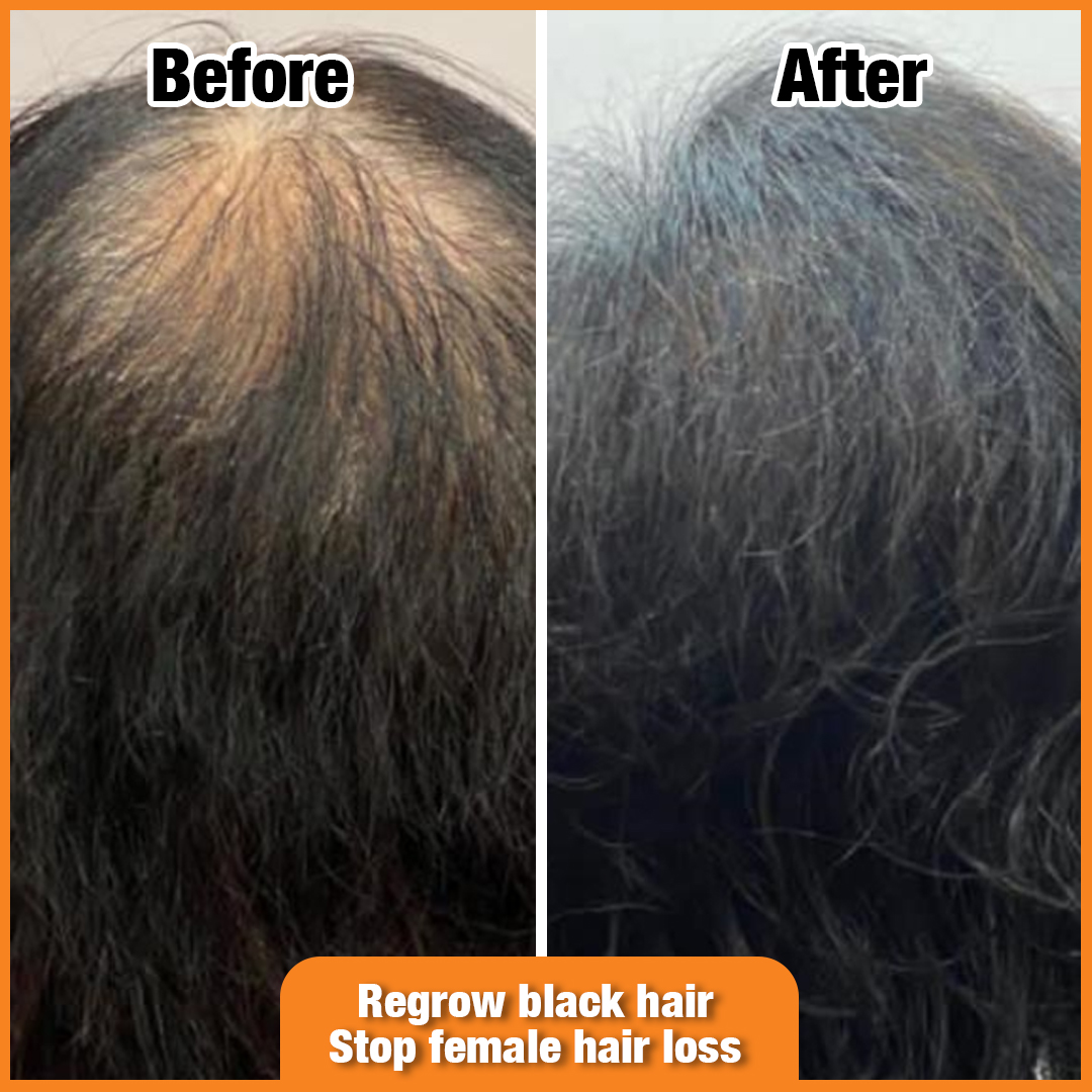 A 'before and after' image showcasing hair regrowth and improved density.