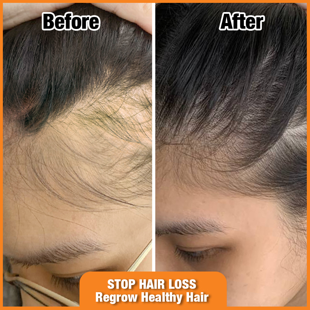 A split image showing hair before and after treatment, with text 'Stop Hair Loss Regrow Healthy Hair'.