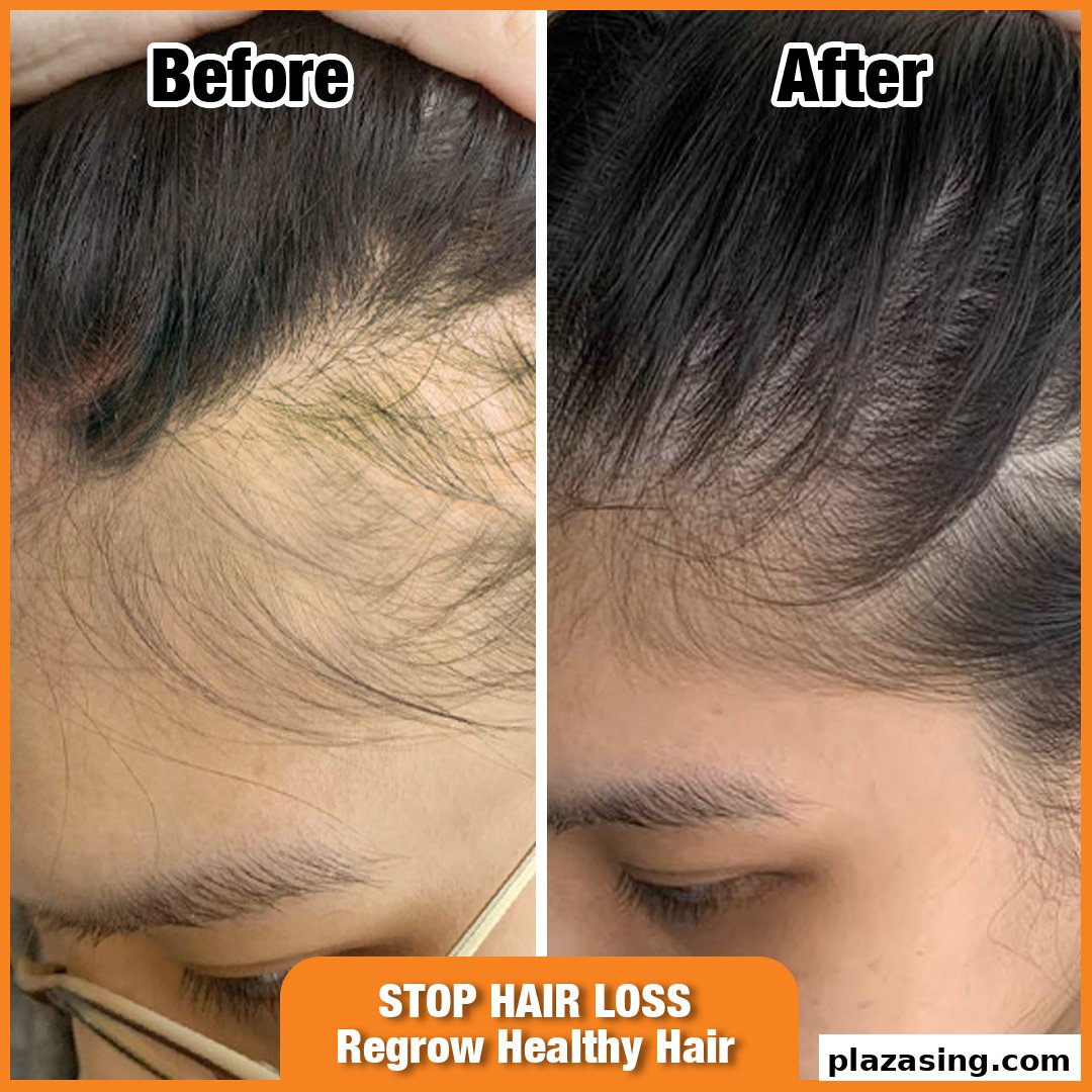 A split image showing hair before and after treatment, with text 'Stop Hair Loss Regrow Healthy Hair'.