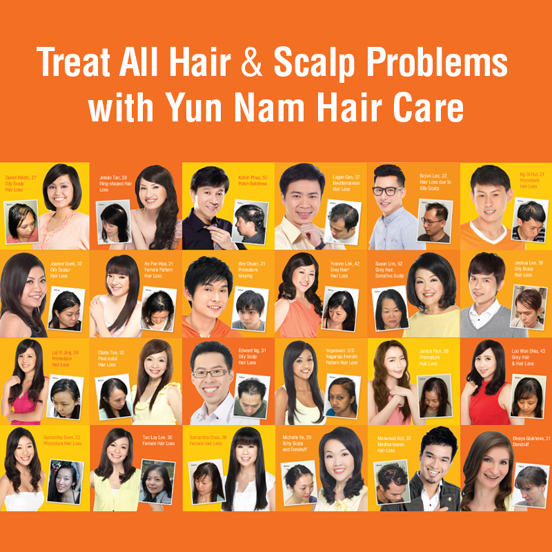A collage of before-and-after photos showcasing successful hair and scalp treatments from Yun Nam Hair Care.