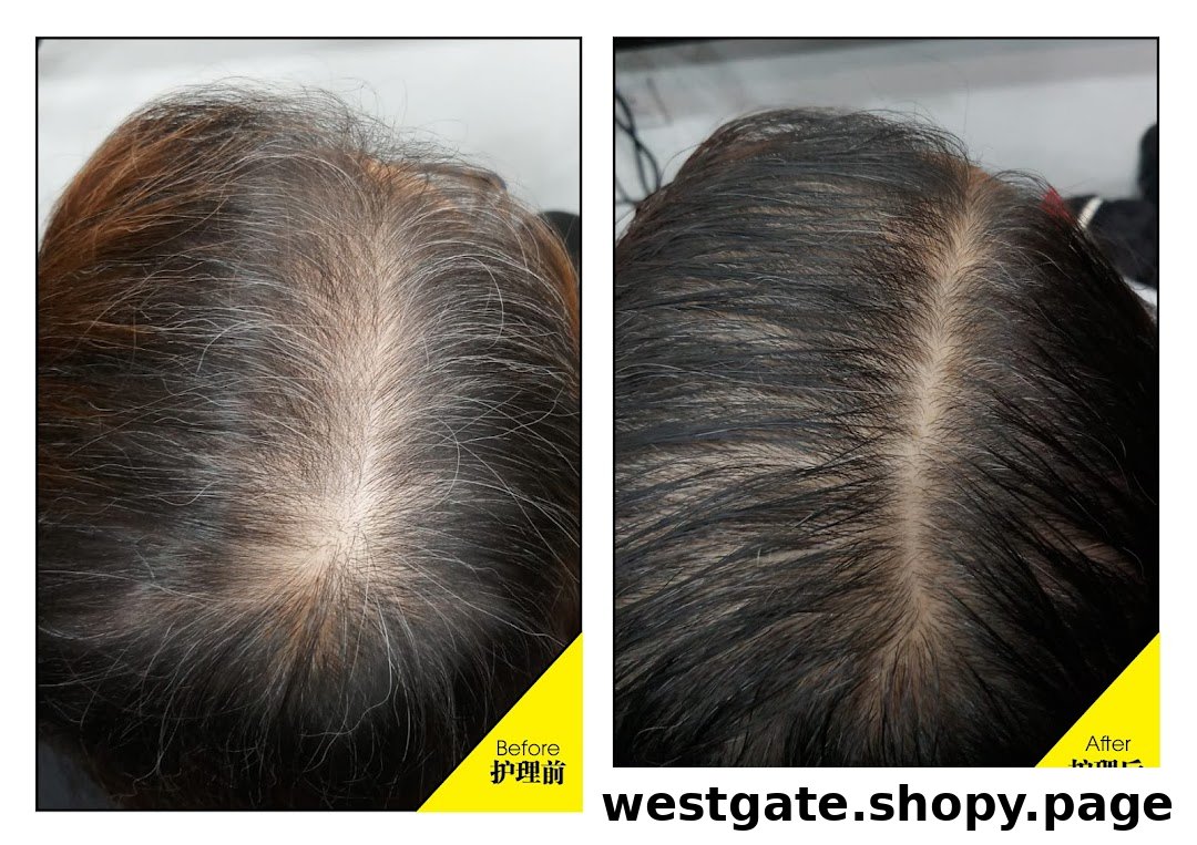 A 'before and after' comparison showcasing hair growth and scalp health improvement.