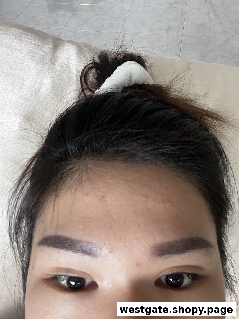 Close-up of a person's face showcasing well-defined eyebrows, likely after an aesthetic treatment.
