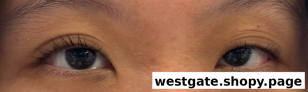 Close-up of a person's eyes with long, dark eyelashes, likely after an aesthetic treatment.