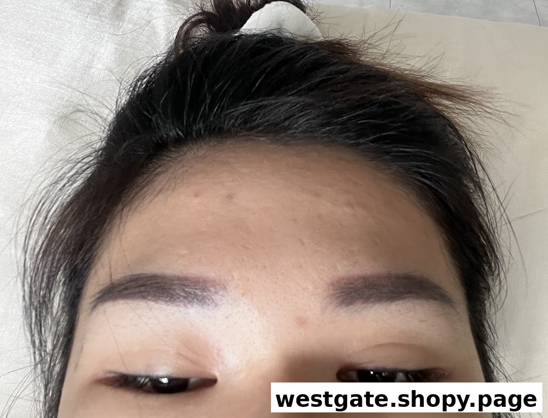 Close-up of a person's face showcasing well-groomed and defined eyebrows after an aesthetic treatment.
