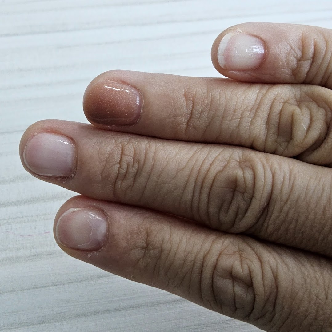 Close-up of a hand showcasing a glittery brown nail polish on one finger and natural nails on others.