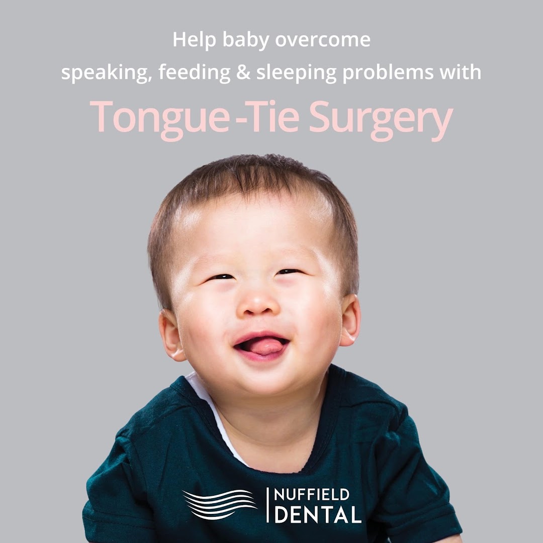 Image shows a happy baby with text promoting Nuffield Dental's tongue-tie surgery for infants.
