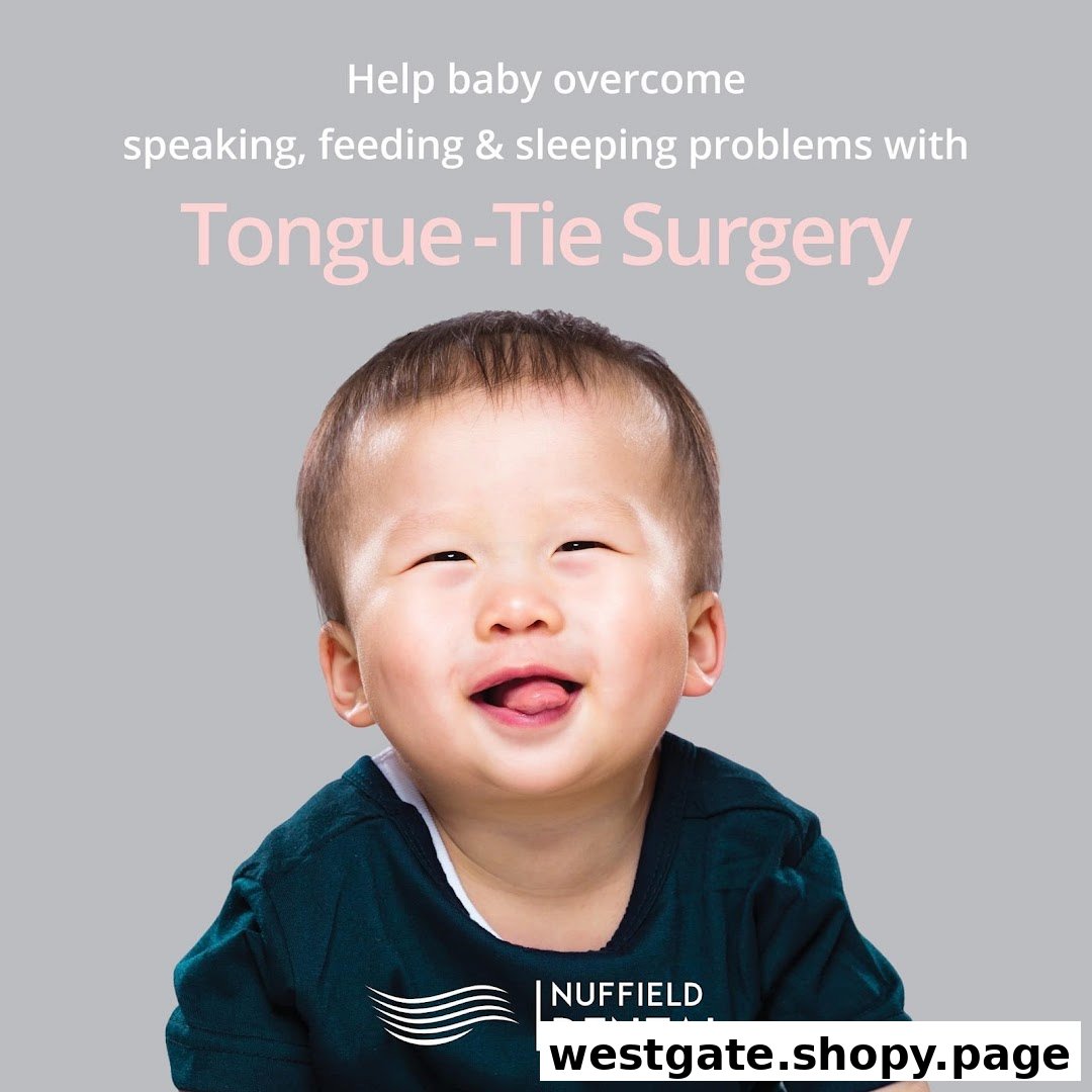 Image shows a happy baby with text promoting Nuffield Dental's tongue-tie surgery for infants.