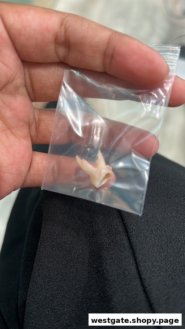 A hand holds an extracted tooth sealed in a small clear plastic bag.